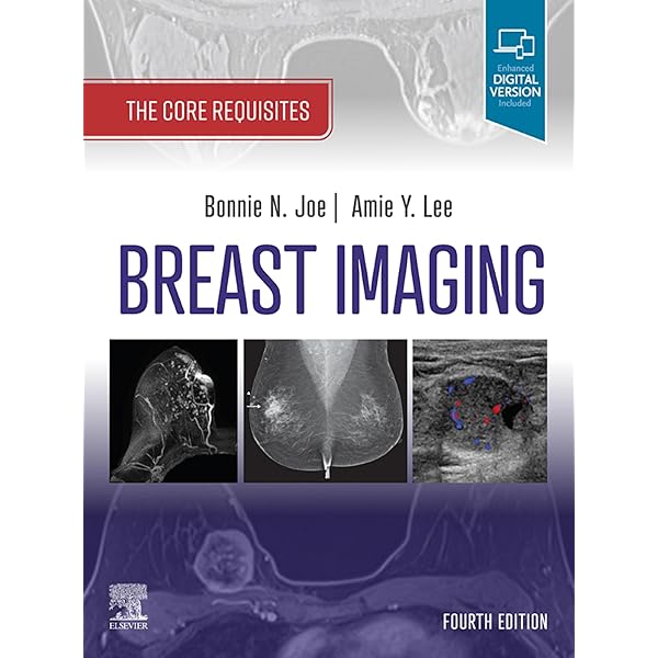 Diagnostic Breast Imaging 第2版 Diagnostic Imaging: Breast: 9780323548120: Medicine & Health